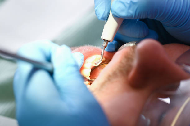 Best Pediatric Emergency Dentist in Rush City, MN