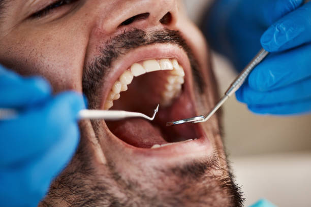 Best Emergency Treatment for Dental Infections or Abscesses in Rush City, MN
